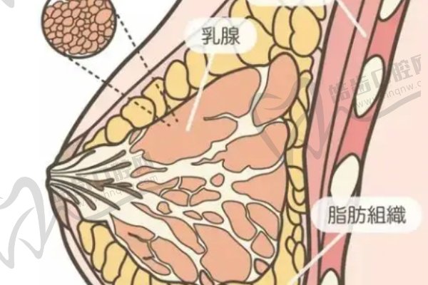 北京艺美王东五元化丰胸108000元起，打造自体脂肪黄金软胸技术精湛效果好,医院正规满意度高