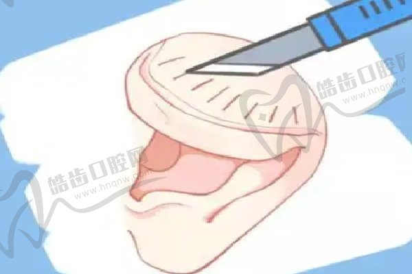 威兹曼马少林博士耳再造预约挂号流程揭秘：是2025新疆最受欢迎的耳再造医生，助您重拾自信！