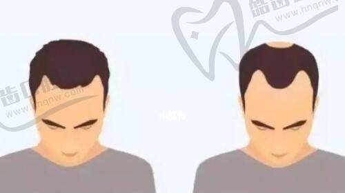 大连董萍整形医院鼻部整形项目价格