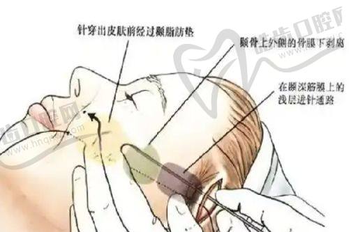 七、黃寺整形美容醫(yī)院院長杜太超醫(yī)生小拉皮優(yōu)勢介紹——專精具有影響力經(jīng)驗多
