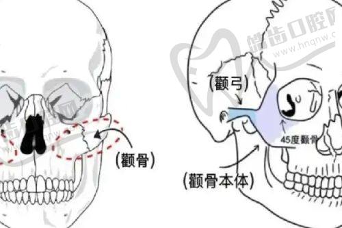八、黃寺整形美容醫(yī)院杜太超醫(yī)生小拉皮單部位提升價格詳情——單部位拉皮價格區(qū)間