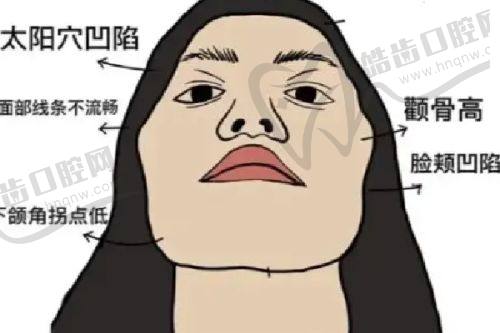 新疆奎屯优兰卡医疗美容诊所详细的预约挂号方式及流程