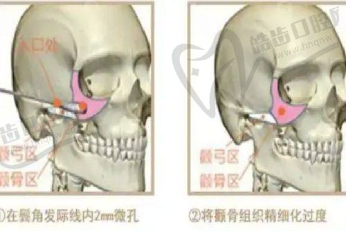 上海安禾美阁医疗美容门诊部收费价格表/收费标准
