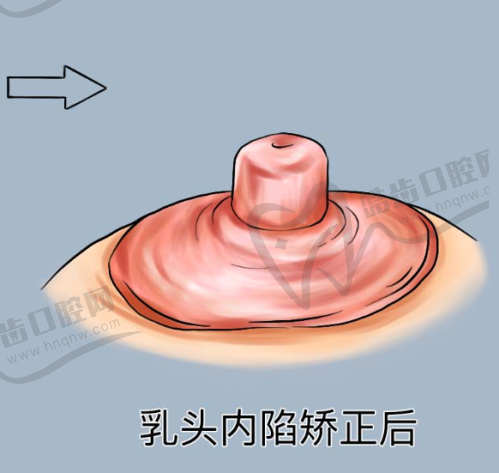 十、黃寺整形美容醫(yī)院杜太超醫(yī)生小拉皮單部位提升價格詳情——性價比優(yōu)勢明顯