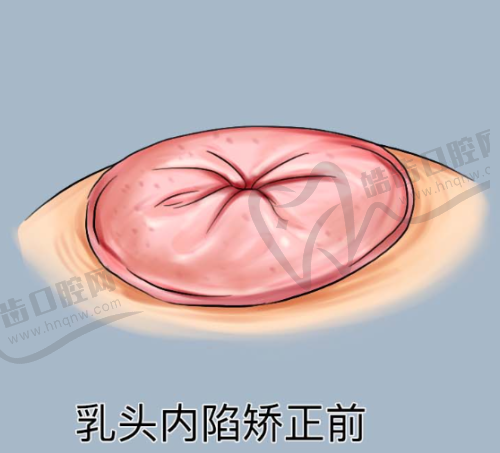 大连董萍整形医院其他整形项目价格