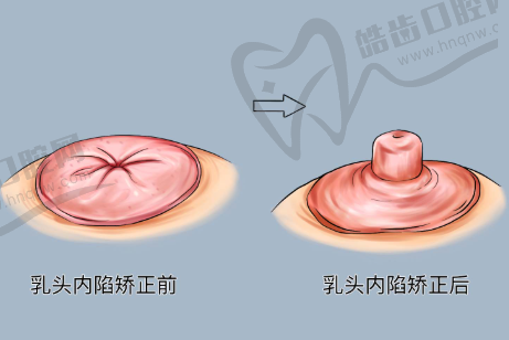 大连董萍整形医院抗衰老项目价格