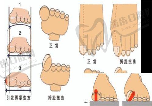 四、赛诺龙超皮秒祛斑的独特优势