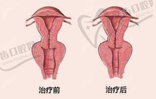 杭州乐可杏仁医疗美容门诊特色项目及技术优势