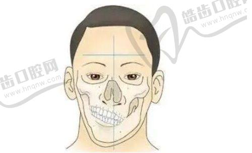 四、任华英医生去胎记的独特优势