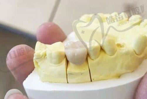 广州广大口腔牙齿美白的服务流程是怎样的？