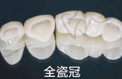 清华阳光矫正牙齿收费明细：传统矫正6980元，隐适美36800元，医保报销情况？