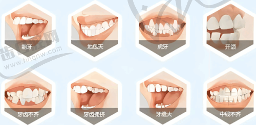 广州广大口腔牙齿美白的售后服务如何？