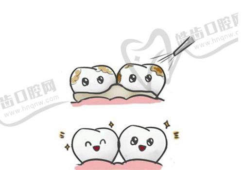 去广州广大口腔进行种植牙需要注意什么？