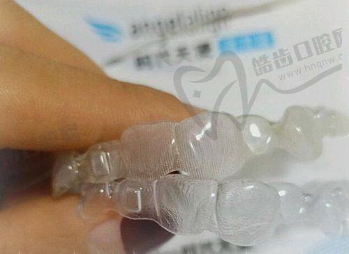 台州府城口腔：种植牙优势明显