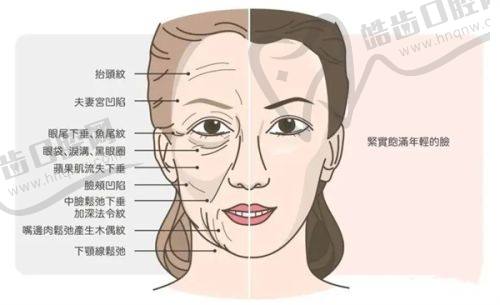 三、光子脱唇毛技术优势盘点