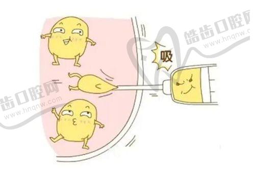 四、光子脱唇毛的独特优势
