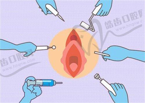 四、李文德医生私密脱毛的独特优势