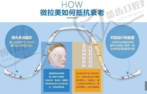 五、真实用户口碑展示