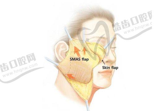 一、吴雅娜个人简介