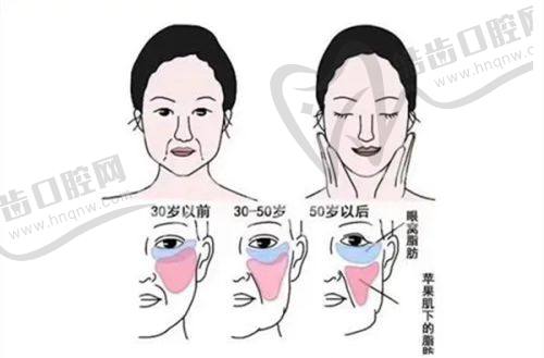 六、无锡坤如玛丽医院及李文德医生私密脱毛手术详情