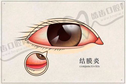 深圳龙华中 心医院眼科医生团队实力强大