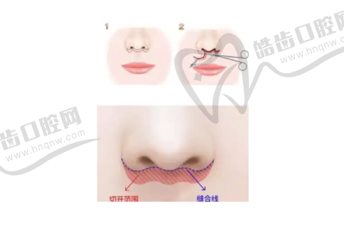 上海華美整形醫(yī)院與逸美大紅玻尿酸項(xiàng)目相關(guān)其他類型的收費(fèi)價(jià)格參考
