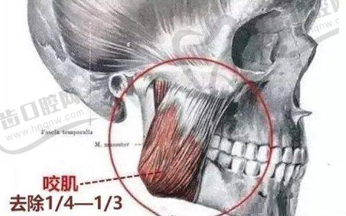 宁波鄞悦纤姿医疗美容门诊部简介概述