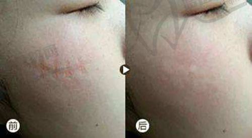 长春圣婉丽医疗美容门诊部真人口碑评价怎么样？