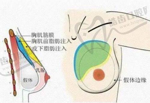 广药三院皮肤疤痕科收费情况
