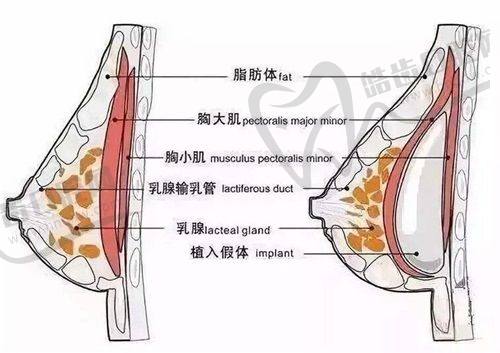 乔雅登使用注意事项