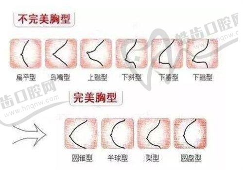 菲林普利隆鼻的微创自然实例