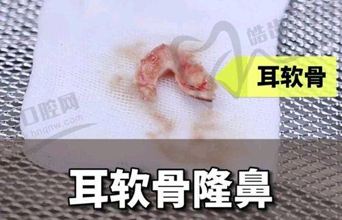 杭州青琴怡美医疗美容诊所特色项目及技术优势
