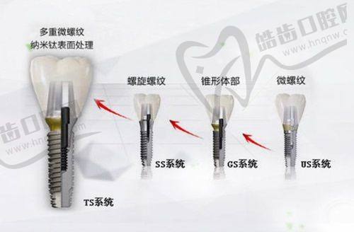 江苏连云港康桥口腔的特色项目及技术优势