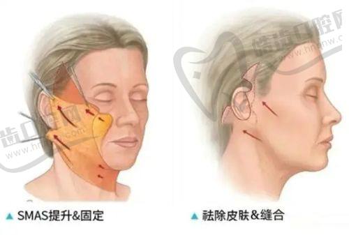 长春廉娜医疗美容门诊部真人口碑评价怎么样？