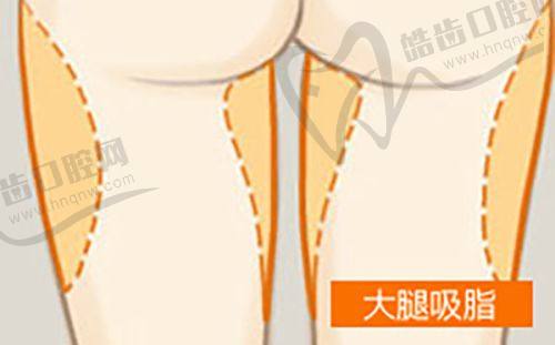 宁波壹加壹医疗美容医院特色项目及技术优势