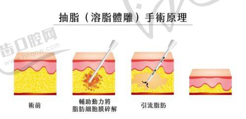宁波壹加壹医疗美容医院详细的预约挂号方式及流程