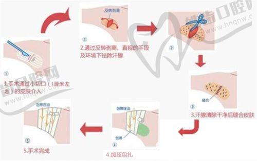 深圳富华整形孙占峰注射海魅玻尿酸，6800元起享孙占峰精湛注射技术