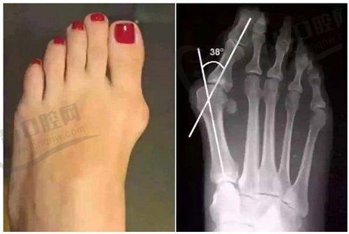 付兰芹医生的口碑评价反馈