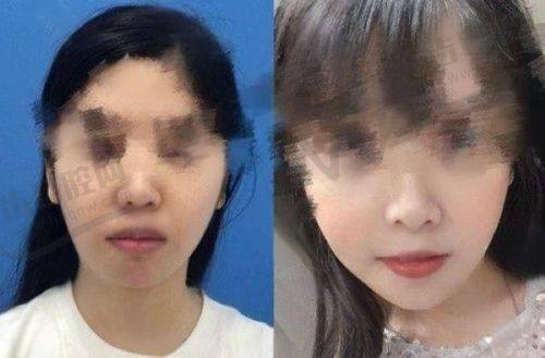 赵军舰吸脂能力如何吊打同行？