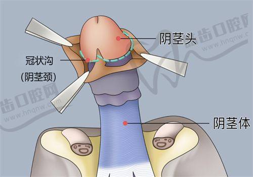 周玉梅医生的口碑评价及真实实例反馈