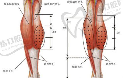 深圳富华整形孙占峰注射艾莉薇玻尿酸，5800元享长效填充孙占峰精细注射技术