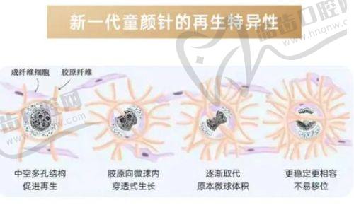 上海安禾美阁聂文婷院长擅长项目