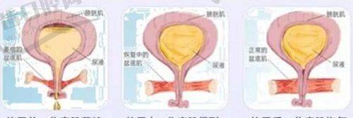 刘劲文医生擅长项目