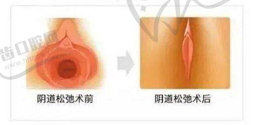 袁杰医生在北京英煌医疗美容擅长的医美项目