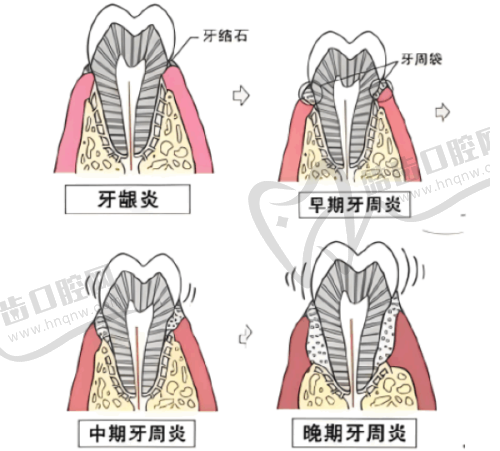 1、天津牙诚口腔门诊部是正规医院吗？