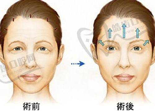 重庆松山医院正颌手术肖林，预约便捷畅享优质服务
