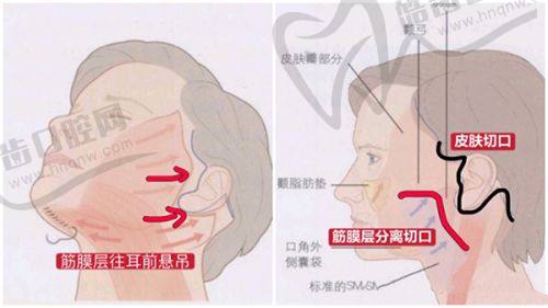 重庆松山医院整形科优势揭秘：专精技术，多样项目