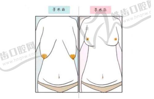 上海安禾美阁刘家贺医生技术优势