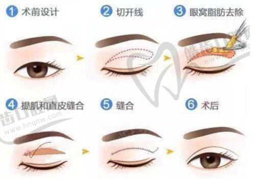 李兴东医生的个人资料简介