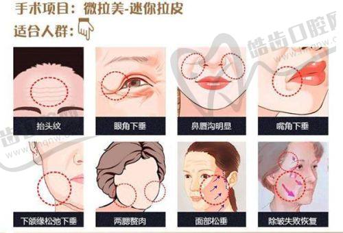 重庆松山医院院长是谁？李喆擅筋膜提升技术优、口碑好值得选——筋膜提升技术优势